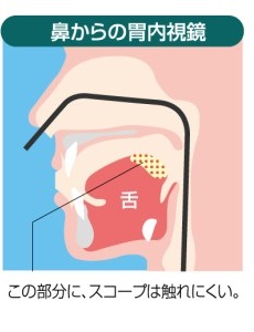 経鼻内視鏡