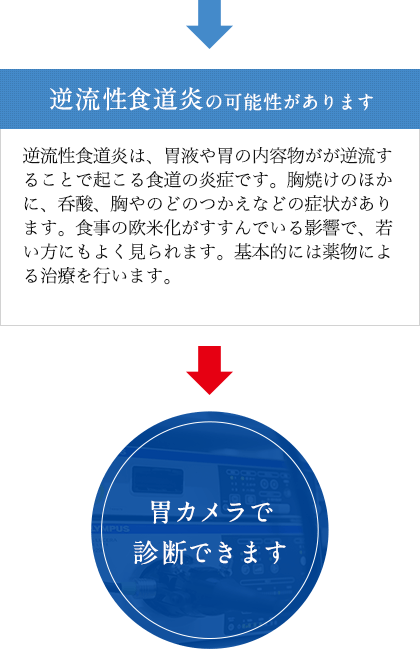 逆流性食道炎の可能性があります