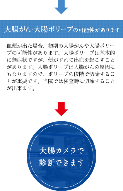 大腸がん・大腸ポリープの可能性があります